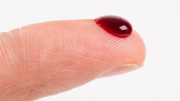 thấy đứt nhưng không chảy máu 